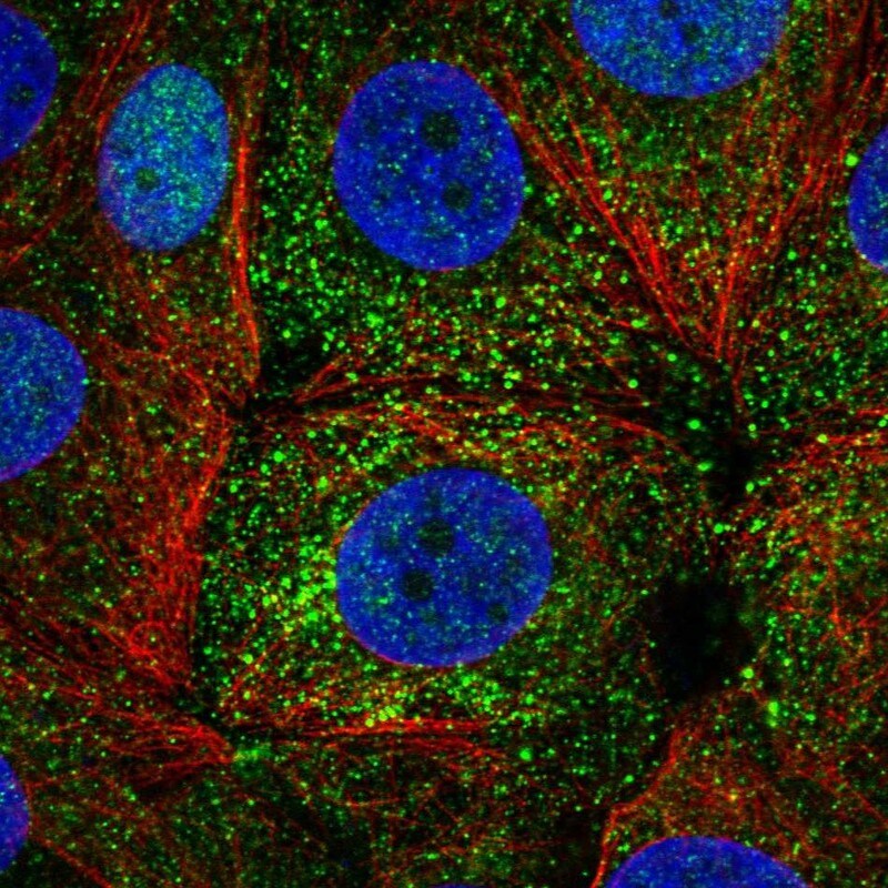 ER alpha/NR3A1 Antibody - BSA Free Immunocytochemistry/ Immunofluorescence: ER alpha/NR3A1 Antibody [NBP1-84827]
