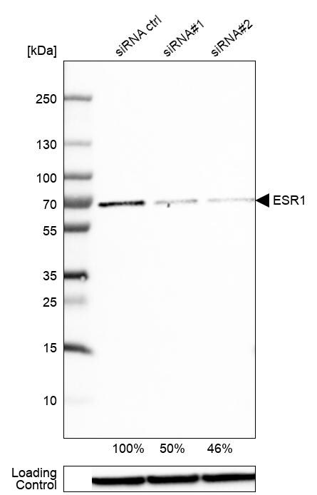 ER alpha/NR3A1 Antibody - BSA Free Western Blot: ER alpha/NR3A1 Antibody - BSA Free [NBP1-84827]