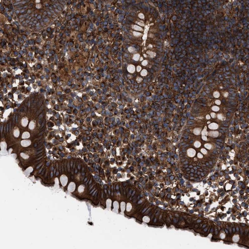 EPS15R Antibody - BSA Free Immunohistochemistry-Paraffin: EPS15R Antibody [NBP1-84828]