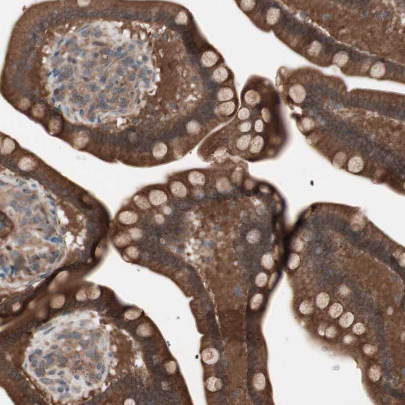 TFPI Antibody - BSA Free Immunohistochemistry-Paraffin: TFPI Antibody - BSA Free [NBP1-84831]