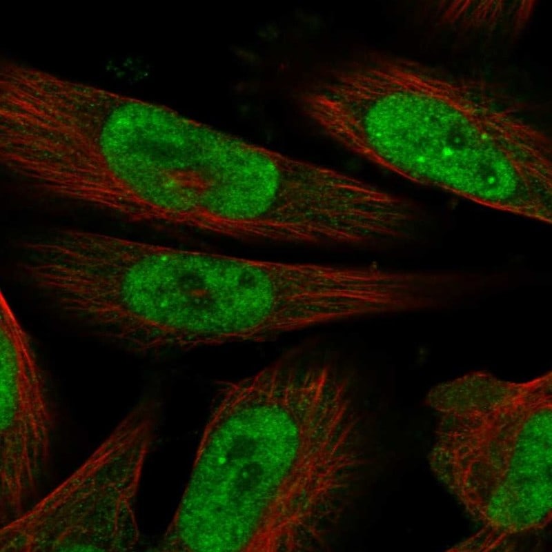 MLLT1 Antibody - BSA Free Immunocytochemistry/ Immunofluorescence: MLLT1 Antibody [NBP1-84840]