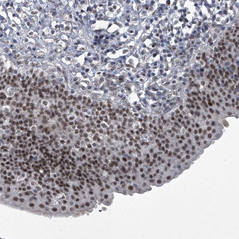 MLLT1 Antibody - BSA Free Immunohistochemistry-Paraffin: MLLT1 Antibody - BSA Free [NBP1-84840]