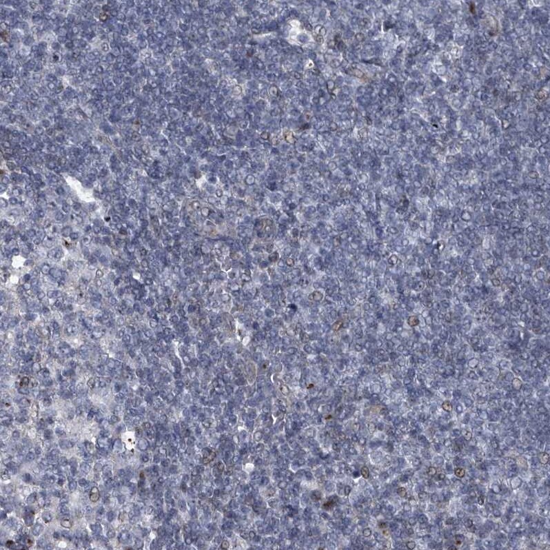 MLLT1 Antibody - BSA Free Immunohistochemistry-Paraffin: MLLT1 Antibody - BSA Free [NBP1-84840]