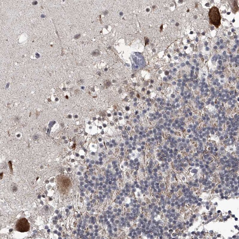 MLLT1 Antibody - BSA Free Immunohistochemistry-Paraffin: MLLT1 Antibody - BSA Free [NBP1-84840]