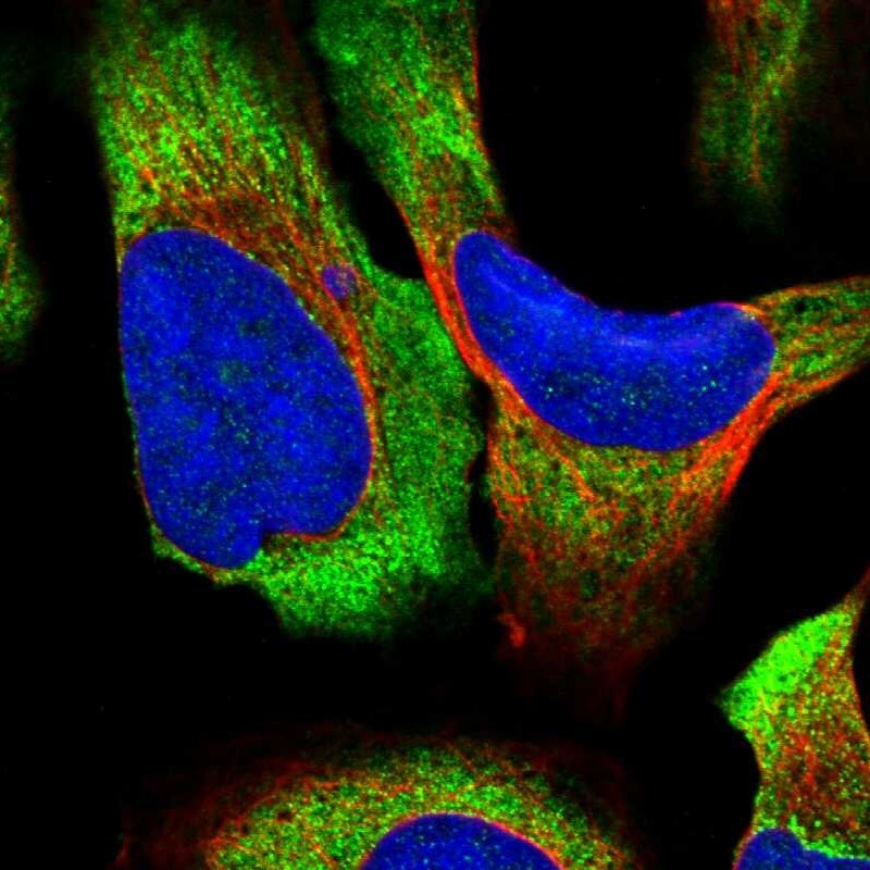 RPS14 Antibody - BSA Free Immunocytochemistry/ Immunofluorescence: RPS14 Antibody [NBP1-84847]