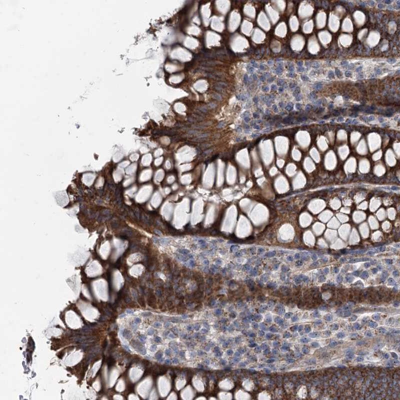 MARK2 Antibody - BSA Free Immunohistochemistry: MARK2 Antibody - BSA Free [NBP1-84848]