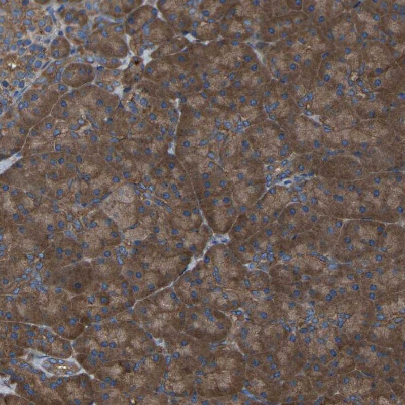 EMAP-II/AIMP1 Antibody - BSA Free Immunohistochemistry-Paraffin: EMAP-II/AIMP1 Antibody - BSA Free [NBP1-84851]