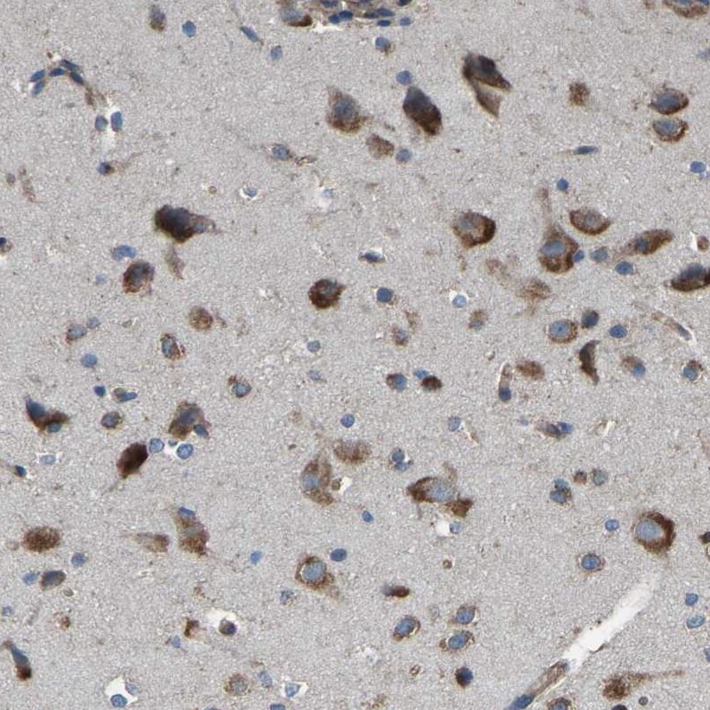 EMAP-II/AIMP1 Antibody - BSA Free Immunohistochemistry-Paraffin: EMAP-II/AIMP1 Antibody - BSA Free [NBP1-84851]
