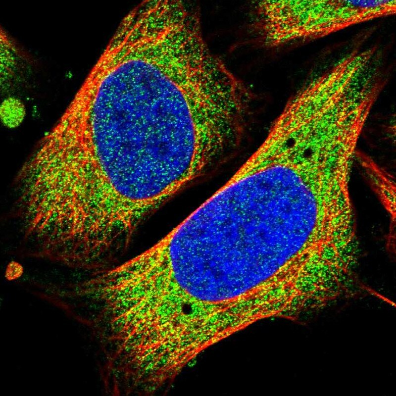 EMAP-II/AIMP1 Antibody - BSA Free Immunocytochemistry/ Immunofluorescence: EMAP-II/AIMP1 Antibody - BSA Free [NBP1-84851]