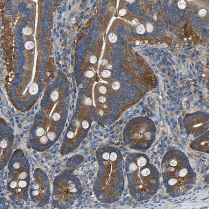 EMAP-II/AIMP1 Antibody - BSA Free Immunohistochemistry-Paraffin: EMAP-II/AIMP1 Antibody - BSA Free [NBP1-84851]