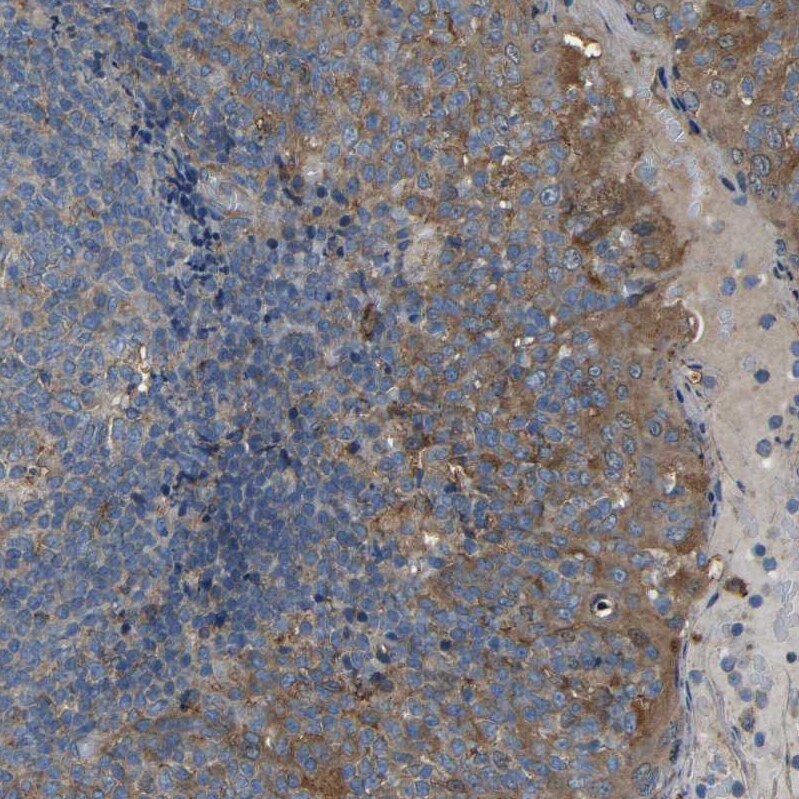 EMAP-II/AIMP1 Antibody - BSA Free Immunohistochemistry-Paraffin: EMAP-II/AIMP1 Antibody - BSA Free [NBP1-84851]