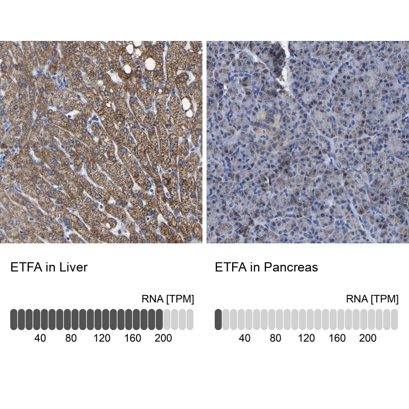 ETFA Antibody - BSA Free Immunohistochemistry-Paraffin: ETFA Antibody [NBP1-84855]