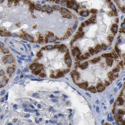 ETFA Antibody - BSA Free Immunohistochemistry-Paraffin: ETFA Antibody [NBP1-84855]