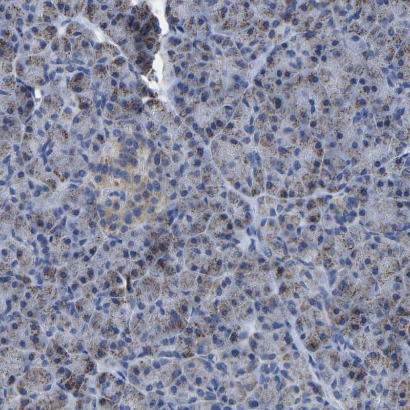 ETFA Antibody - BSA Free Immunohistochemistry-Paraffin: ETFA Antibody [NBP1-84855]