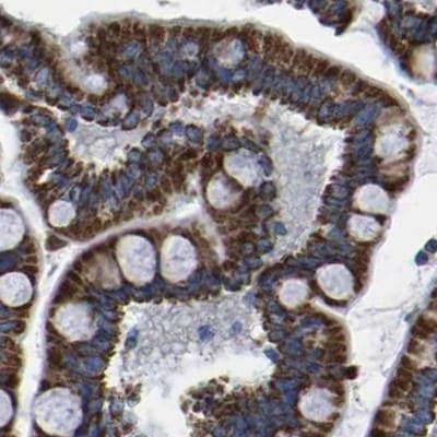ETFA Antibody - BSA Free Immunohistochemistry-Paraffin: ETFA Antibody [NBP1-84855]
