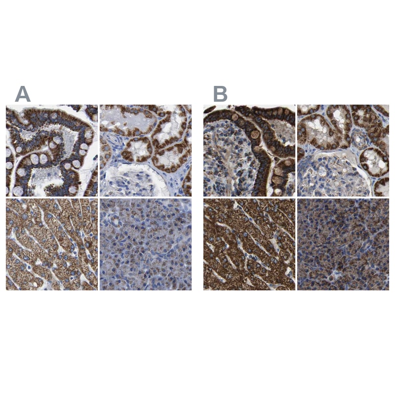 ETFA Antibody - BSA Free Immunohistochemistry-Paraffin: ETFA Antibody [NBP1-84855]