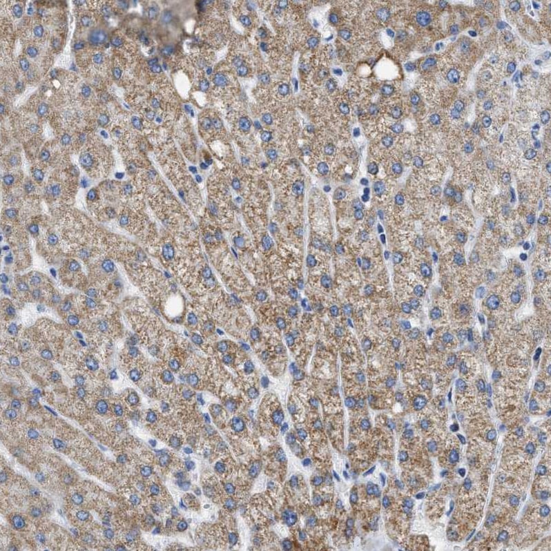 ETFA Antibody - BSA Free Immunohistochemistry-Paraffin: ETFA Antibody [NBP1-84857]