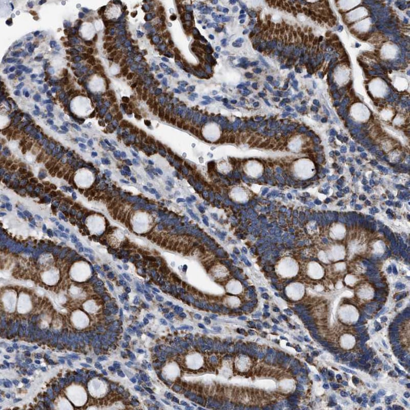 ETFA Antibody - BSA Free Immunohistochemistry-Paraffin: ETFA Antibody [NBP1-84857]