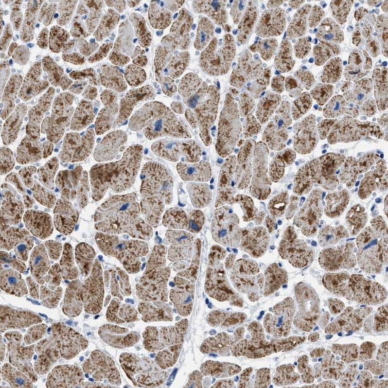 ETFA Antibody - BSA Free Immunohistochemistry-Paraffin: ETFA Antibody [NBP1-84857]