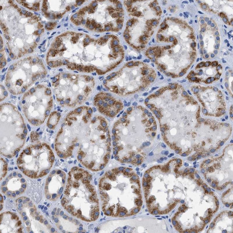 ETFA Antibody - BSA Free Immunohistochemistry-Paraffin: ETFA Antibody [NBP1-84857]