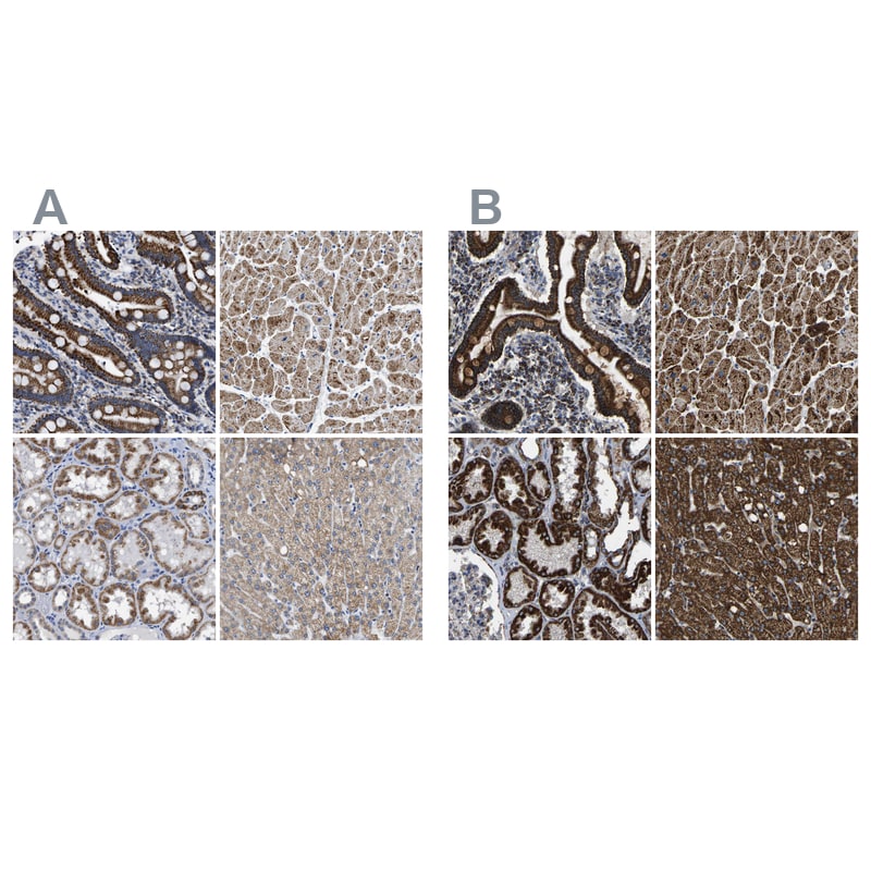 ETFA Antibody - BSA Free Immunohistochemistry-Paraffin: ETFA Antibody [NBP1-84857]
