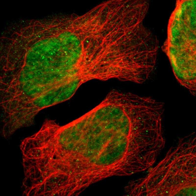 ZNF446 Antibody Immunocytochemistry/ Immunofluorescence: ZNF446 Antibody [NBP1-80593]