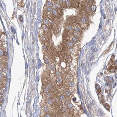 EIF3A Antibody - BSA Free Immunohistochemistry-Paraffin: EIF3A Antibody [NBP1-84876]