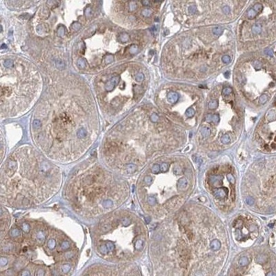 EIF3A Antibody - BSA Free Immunohistochemistry-Paraffin: EIF3A Antibody [NBP1-84876]