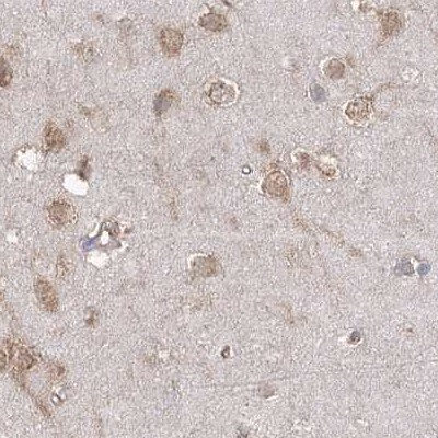 EIF3A Antibody - BSA Free Immunohistochemistry-Paraffin: EIF3A Antibody [NBP1-84876]