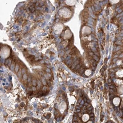 EIF3A Antibody - BSA Free Immunohistochemistry-Paraffin: EIF3A Antibody [NBP1-84876]