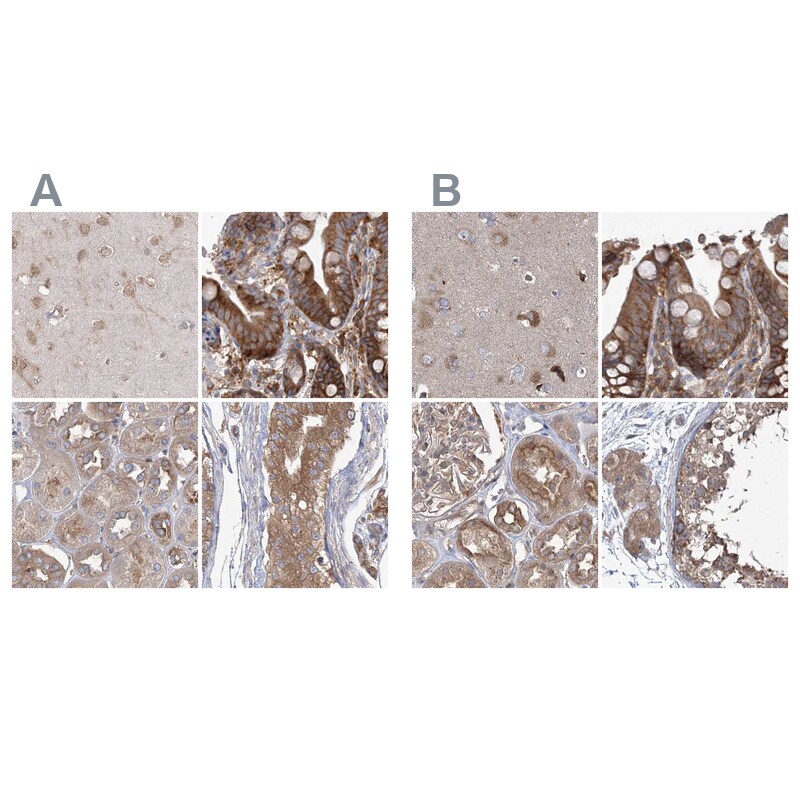 EIF3A Antibody - BSA Free Immunohistochemistry-Paraffin: EIF3A Antibody [NBP1-84876]