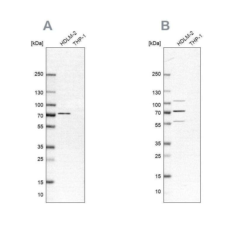 PKR Antibody Western Blot: PKR Antibody Antibody [NBP1-84878]