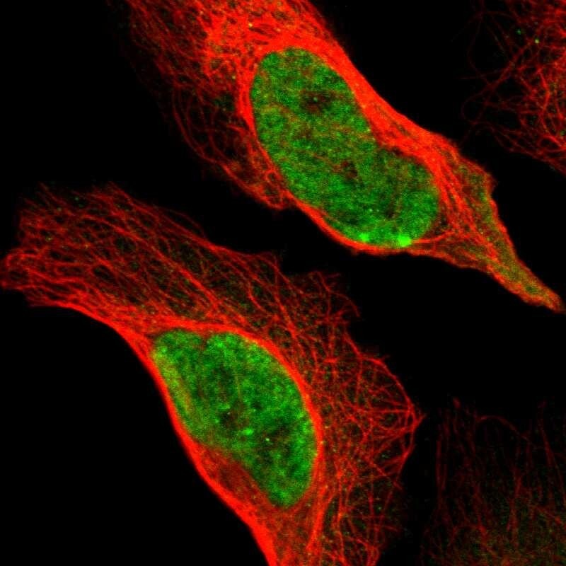 Mre11 Antibody Immunocytochemistry/ Immunofluorescence: Mre11 Antibody [NBP1-90074]