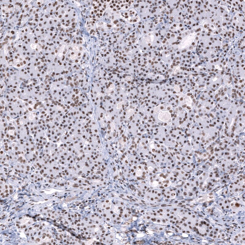 SNRPN Antibody Immunohistochemistry-Paraffin: SNRPN Antibody [NBP1-83280]
