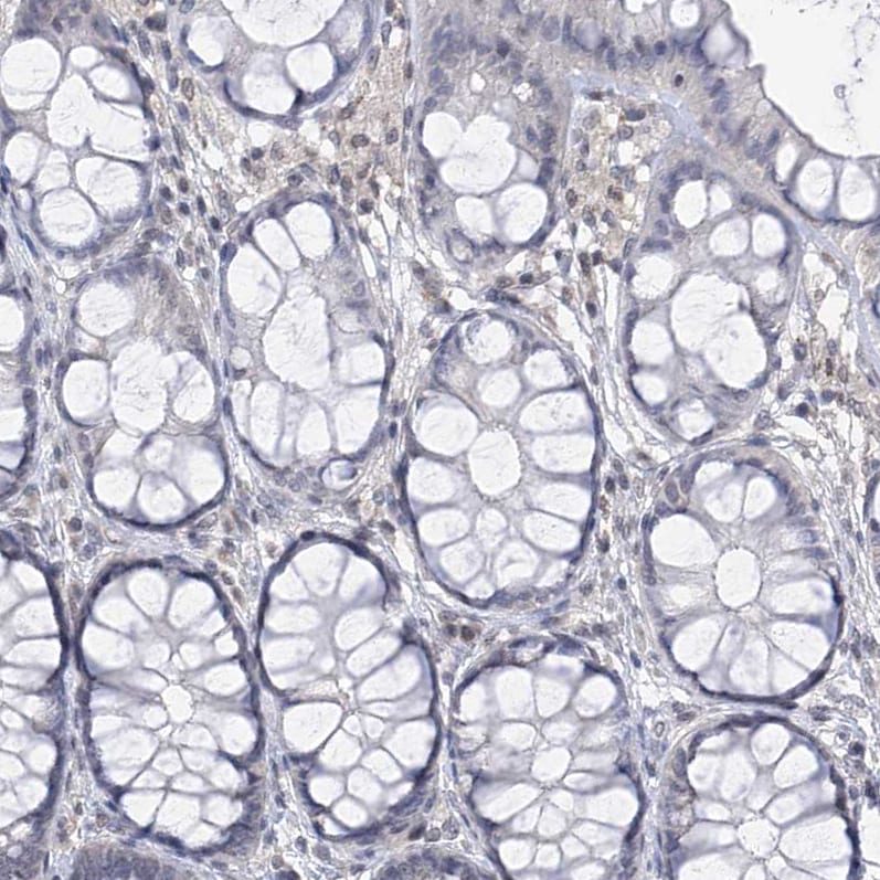 Centrin 2 Antibody Immunohistochemistry-Paraffin: Centrin 2 Antibody [NBP1-88213]