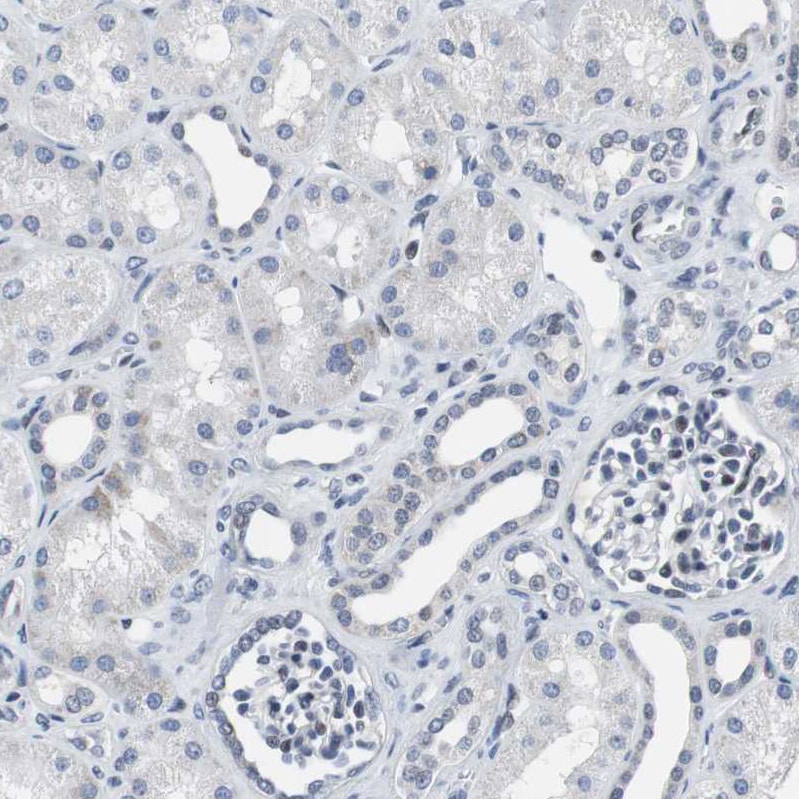 p63/TP73L Antibody Immunohistochemistry-Paraffin: p63/TP73L Antibody [NBP1-84895]