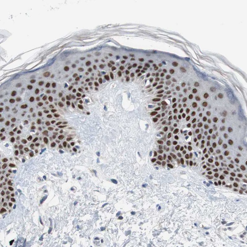 p63/TP73L Antibody Immunohistochemistry-Paraffin: p63/TP73L Antibody [NBP1-84895]