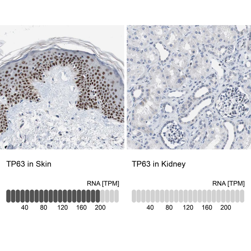 p63/TP73L Antibody Immunohistochemistry-Paraffin: p63/TP73L Antibody [NBP1-84895]