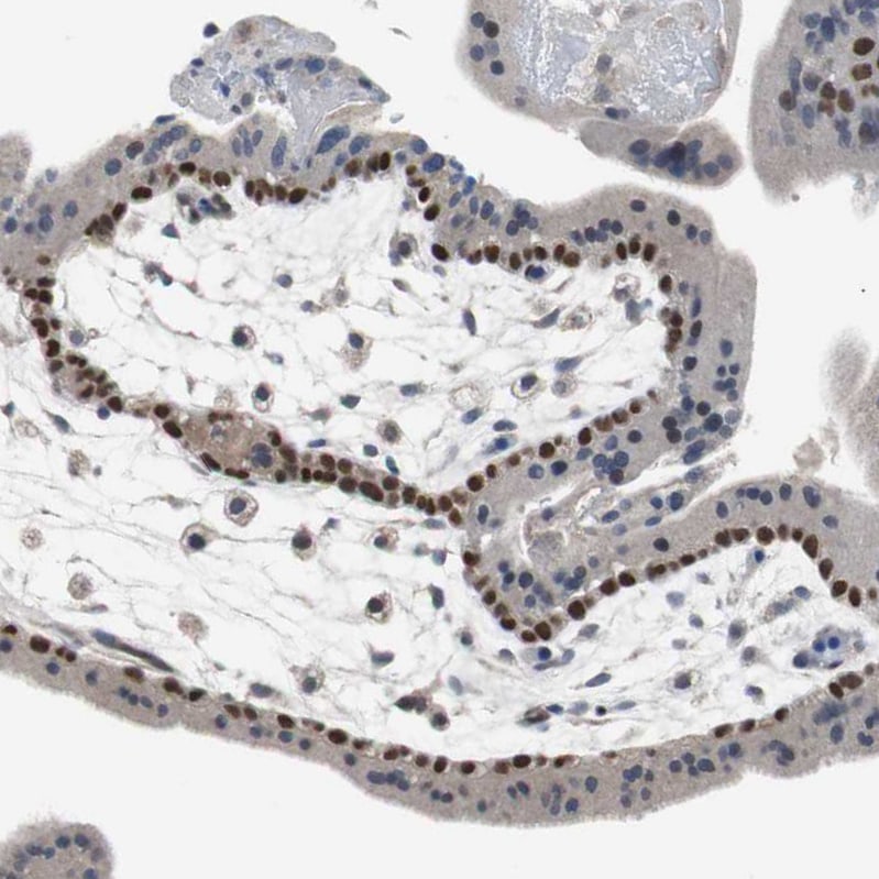 p63/TP73L Antibody Immunohistochemistry-Paraffin: p63/TP73L Antibody [NBP1-84895]
