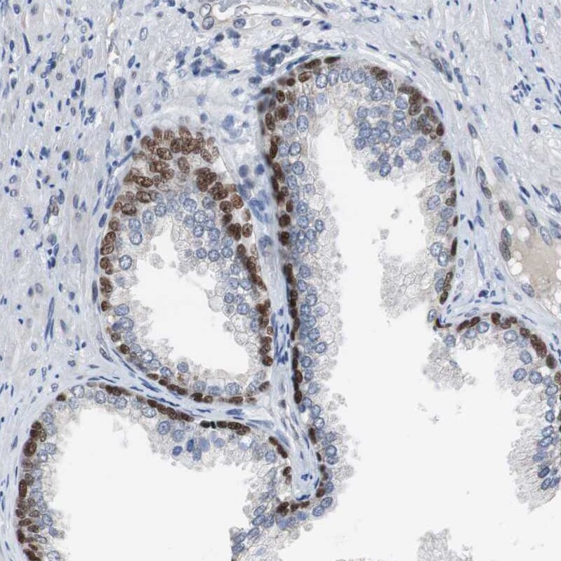 p63/TP73L Antibody Immunohistochemistry-Paraffin: p63/TP73L Antibody [NBP1-84895]