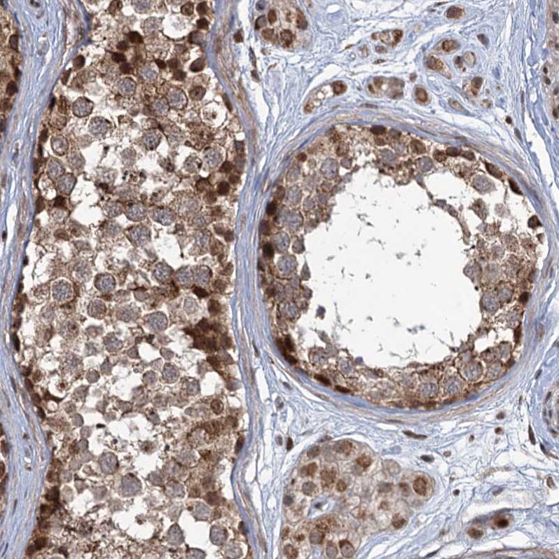 PHC3 Antibody - BSA Free Immunohistochemistry-Paraffin: PHC3 Antibody [NBP1-84896]