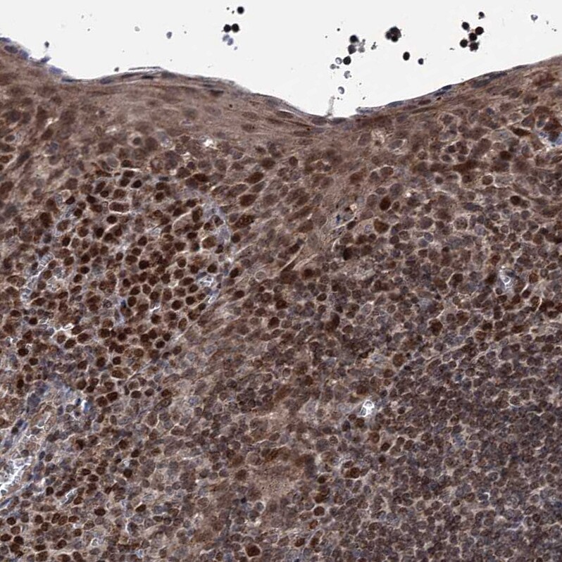 PHC3 Antibody - BSA Free Immunohistochemistry-Paraffin: PHC3 Antibody [NBP1-84896]