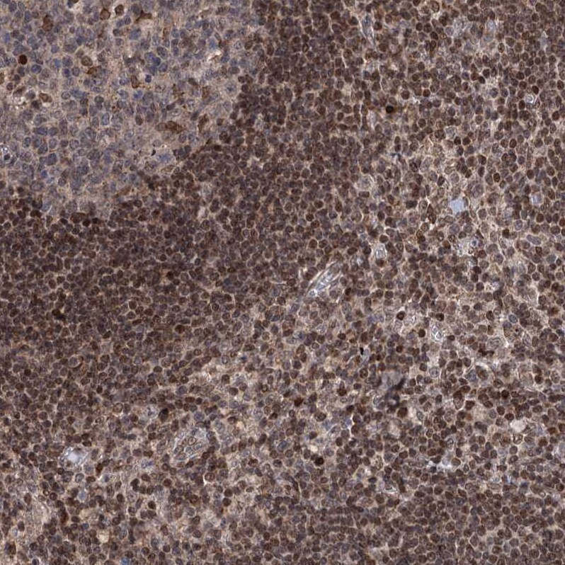 PHC3 Antibody - BSA Free Immunohistochemistry-Paraffin: PHC3 Antibody [NBP1-84896]