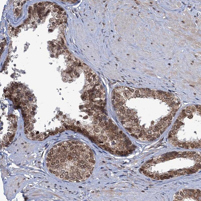 PHC3 Antibody - BSA Free Immunohistochemistry-Paraffin: PHC3 Antibody [NBP1-84896]