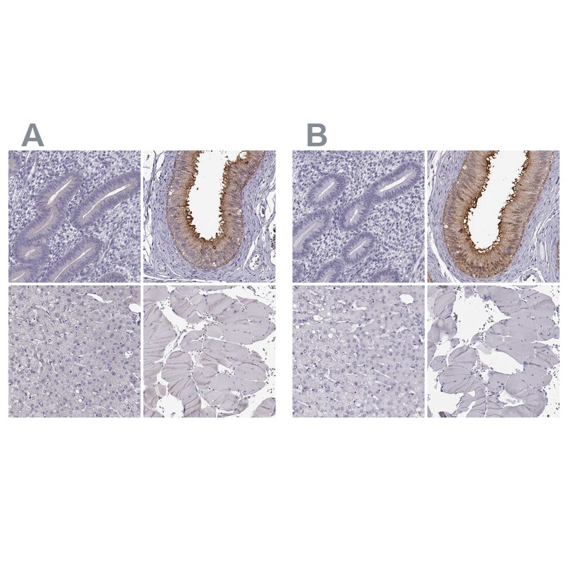 GPR64 Antibody - BSA Free Immunohistochemistry-Paraffin: GPR64 Antibody - BSA Free [NBP1-84906]
