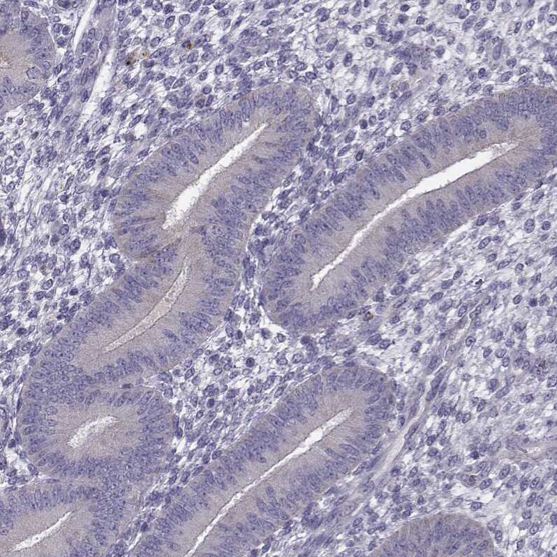 GPR64 Antibody - BSA Free Immunohistochemistry-Paraffin: GPR64 Antibody - BSA Free [NBP1-84906]