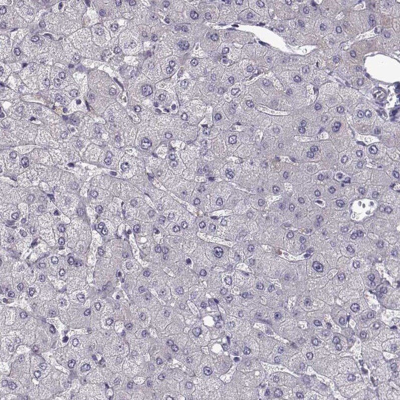 GPR64 Antibody - BSA Free Immunohistochemistry-Paraffin: GPR64 Antibody - BSA Free [NBP1-84906]