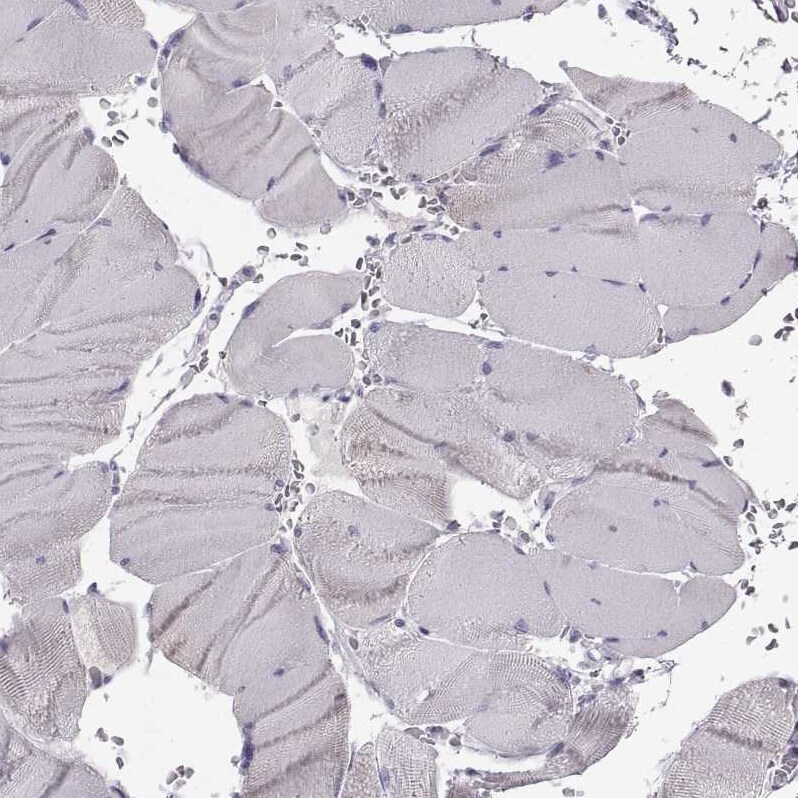 GPR64 Antibody - BSA Free Immunohistochemistry-Paraffin: GPR64 Antibody - BSA Free [NBP1-84906]