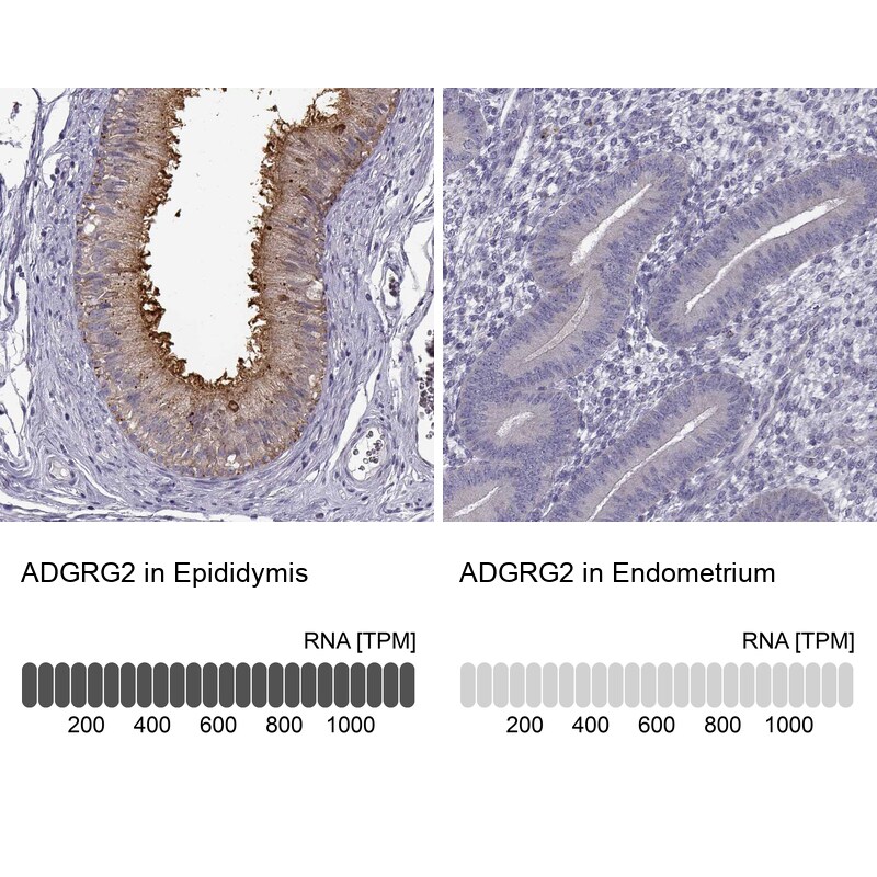 GPR64 Antibody - BSA Free Immunohistochemistry-Paraffin: GPR64 Antibody - BSA Free [NBP1-84906]