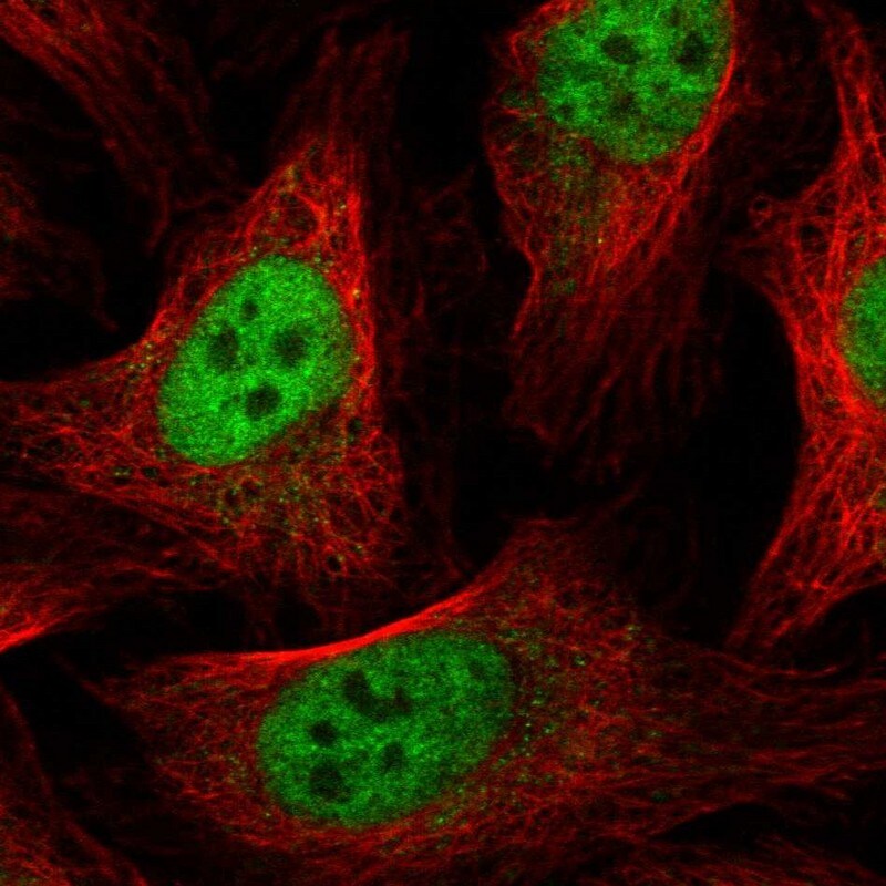 GABPA Antibody - BSA Free Immunocytochemistry/ Immunofluorescence: GABPA Antibody [NBP1-84941]